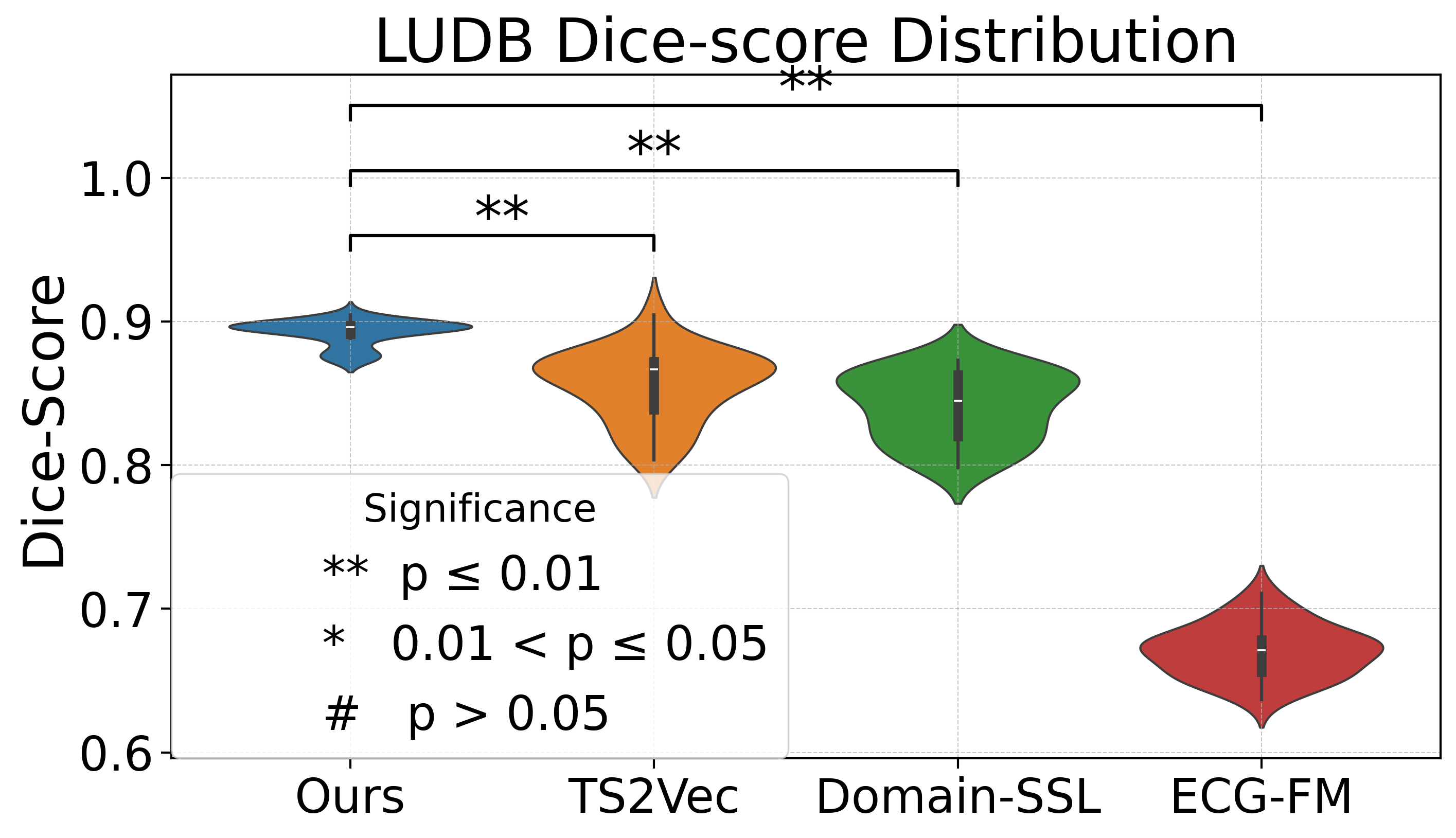 Comparison on LUDB segmentation - Dice-score