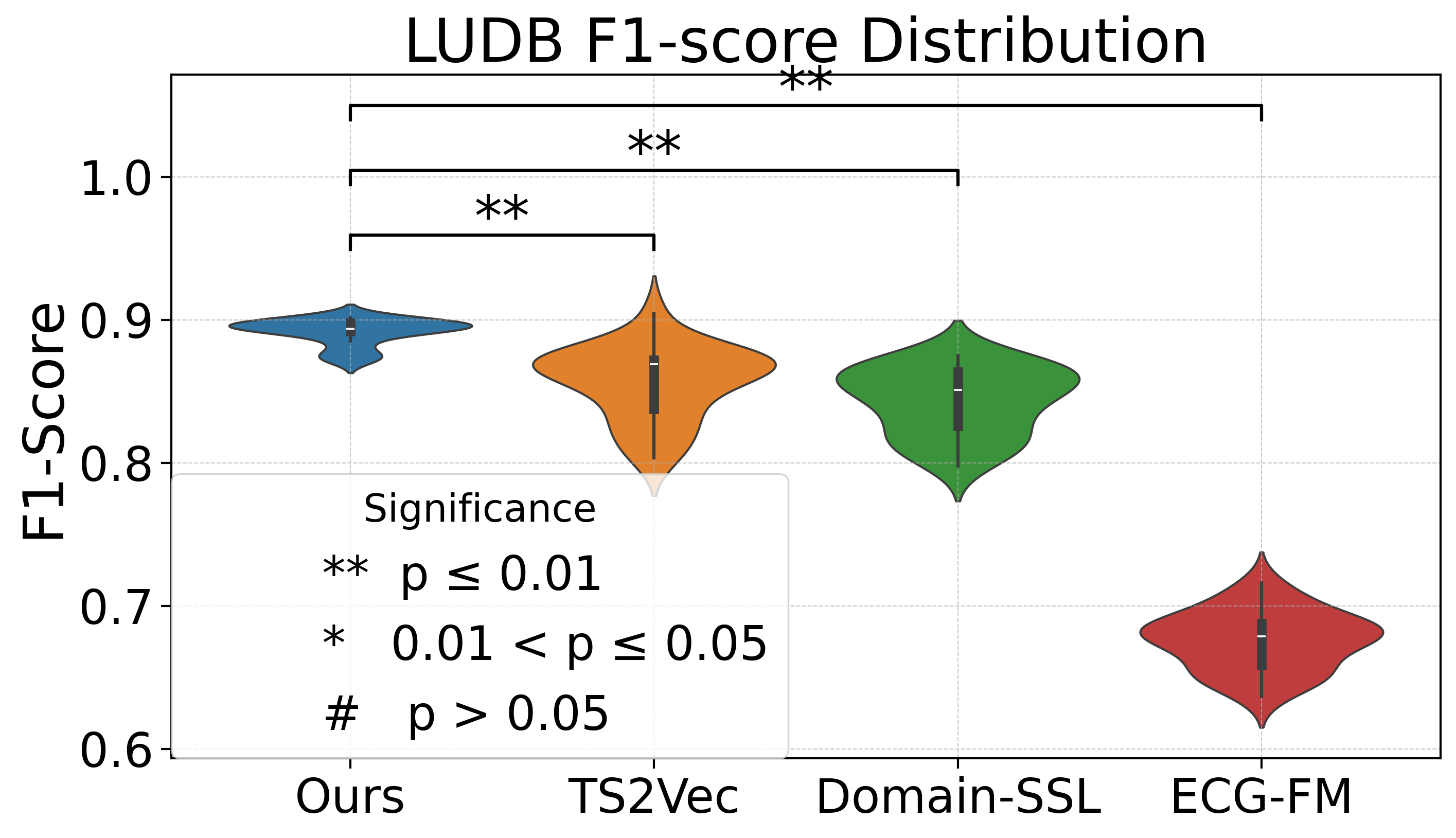 Comparison on LUDB segmentation - F1-score