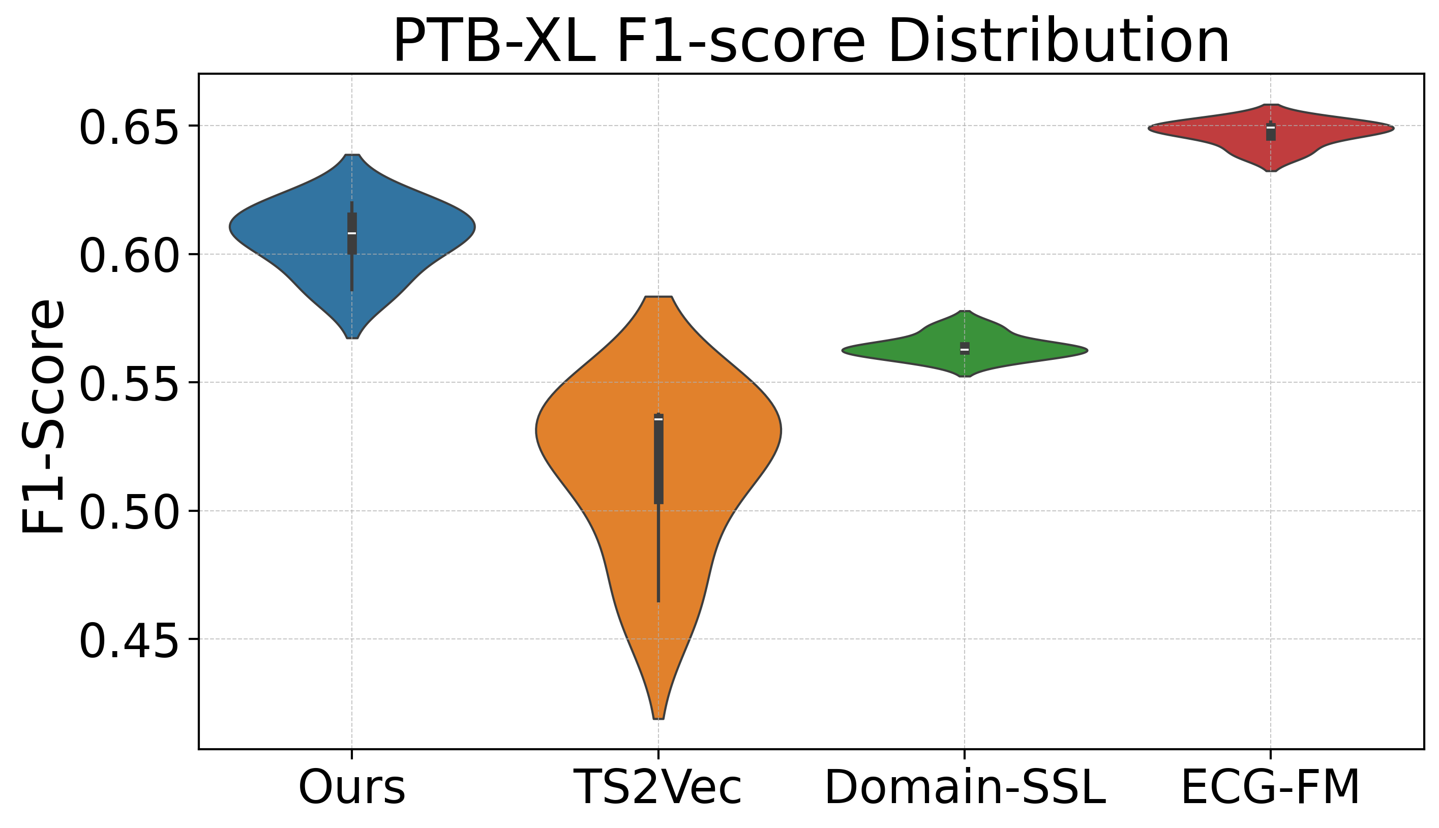 Comparison on PTB-XL Dataset